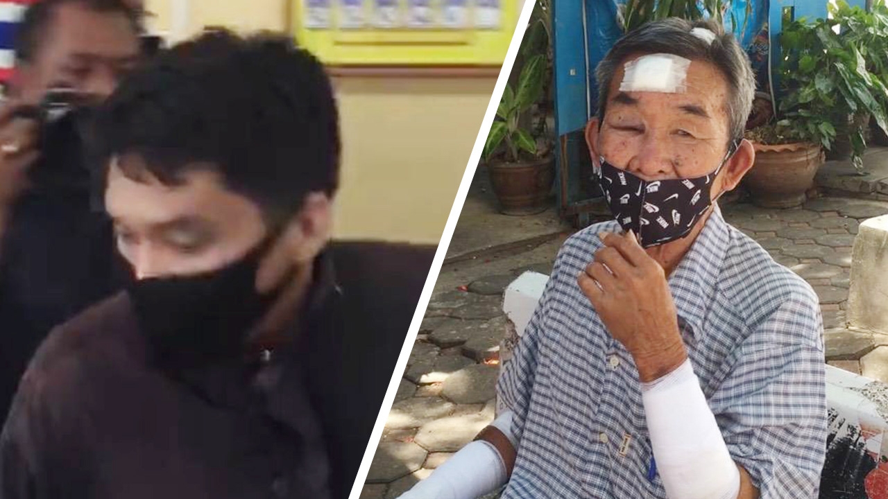 เย็บ 9 เข็ม ลุงแท็กซี่เหยื่อหนุ่มหัวร้อน ลั่นผมไม่ตายก็บุญแล้ว