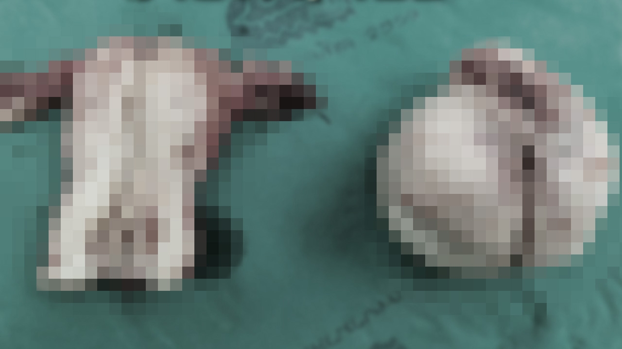 อย่ากลัวที่จะหาหมอ แนะวิธีสังเกต "เนื้องอกในมดลูก" โรคฮิตของสาววัยทำงาน