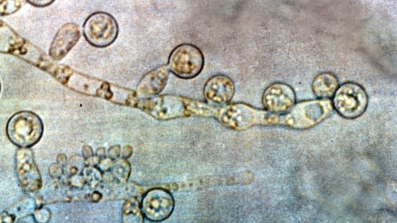 พัฒนาการเคลือบโพลิเมอร์จัดการเชื้อรา