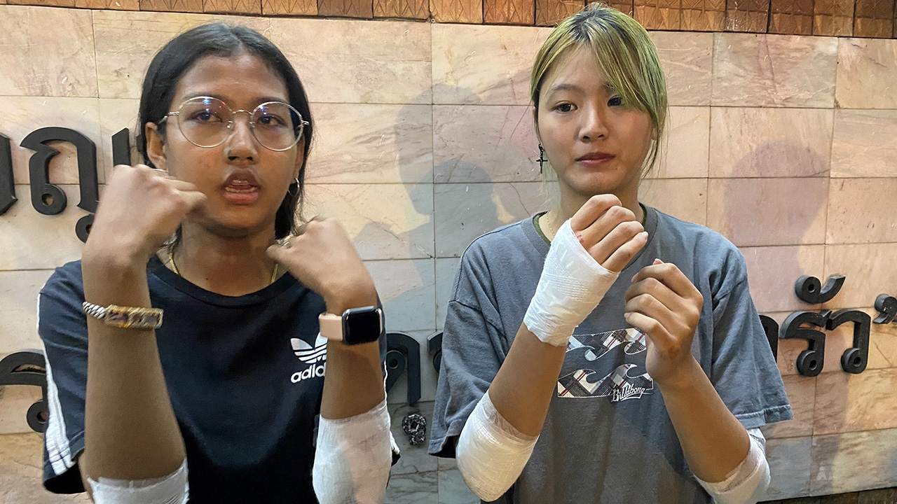 ไบเกอร์โชว์แผล 