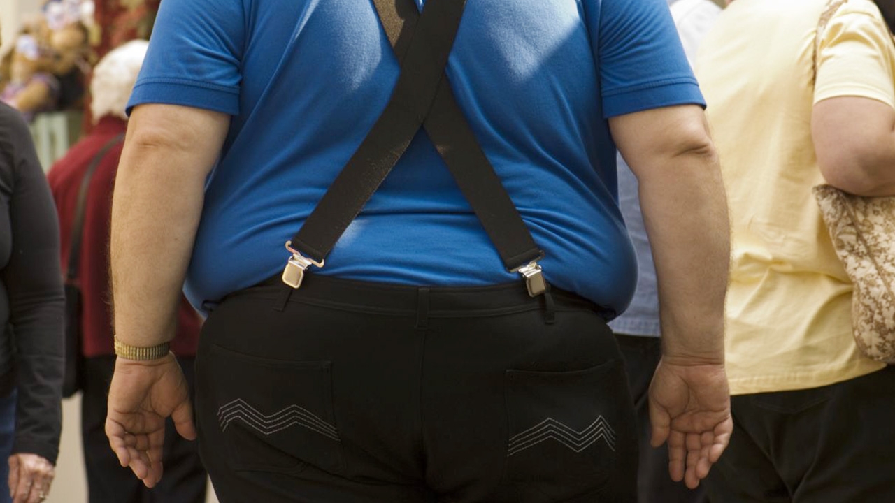 พบคนอเมริกัน ติดเชื้อโควิด-19 ส่วนใหญ่เป็นโรคอ้วน 