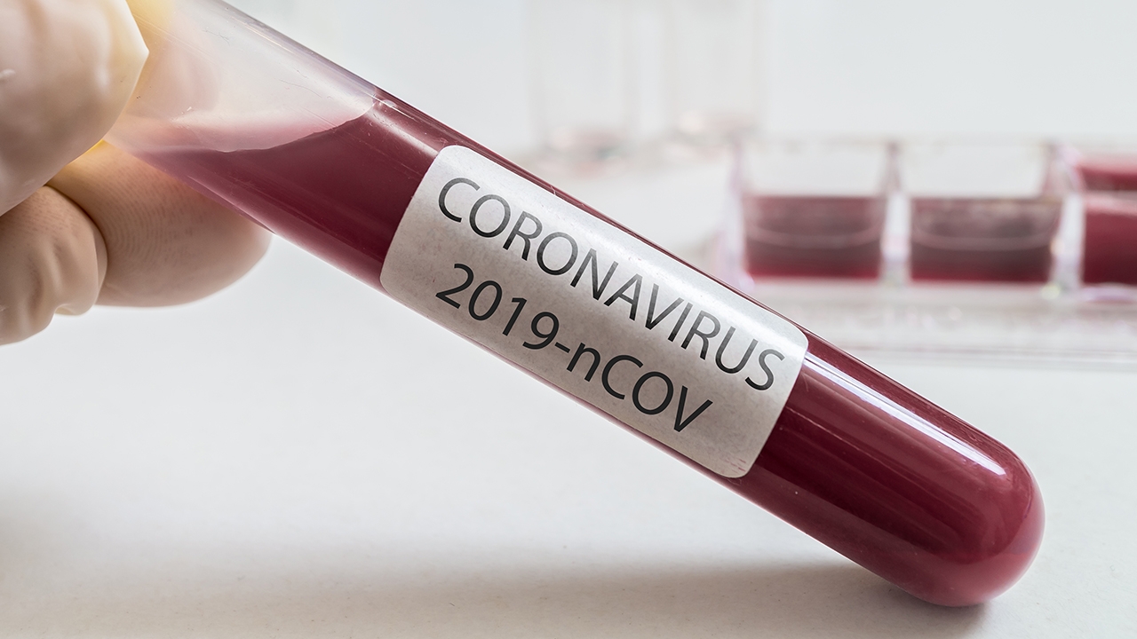 ติดเชื้อรายใหม่มากสุดมาจากสัมผัสผู้ป่วยก่อนหน้า อีก 9 จังหวัดยังไร้รายงาน