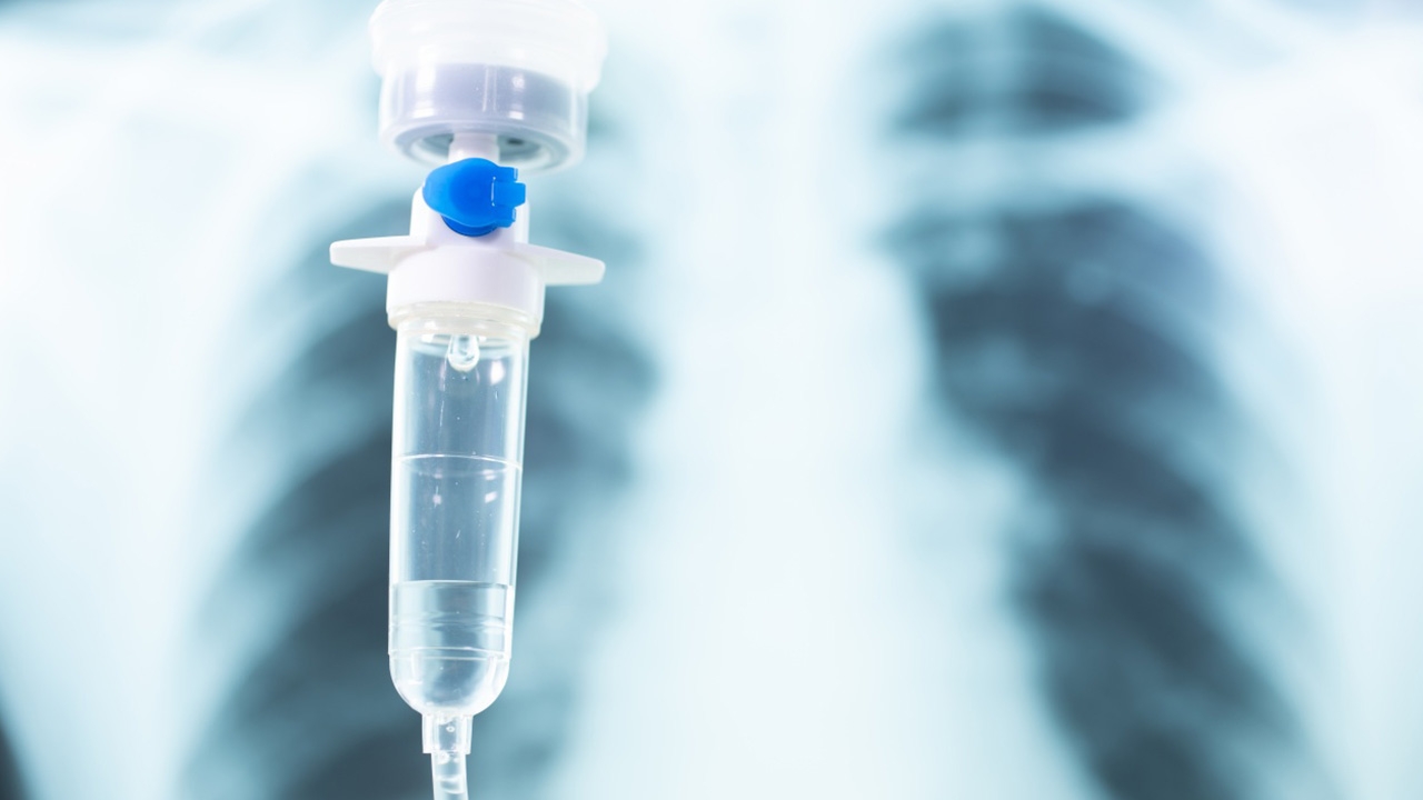 ไทม์ไลน์ หญิงขอนแก่นป่วย "โควิด-19" อาการหนัก เชื้อทำลายปอดเกินครึ่ง