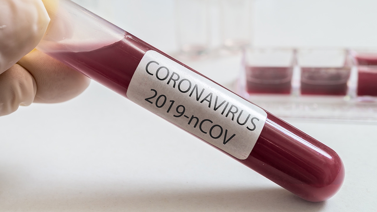 กรมควบคุมโรค แจงชายไทยอายุ 49 ปี พบเชื้อ "โควิด-19" เป็นการติดเชื้อรายเก่า