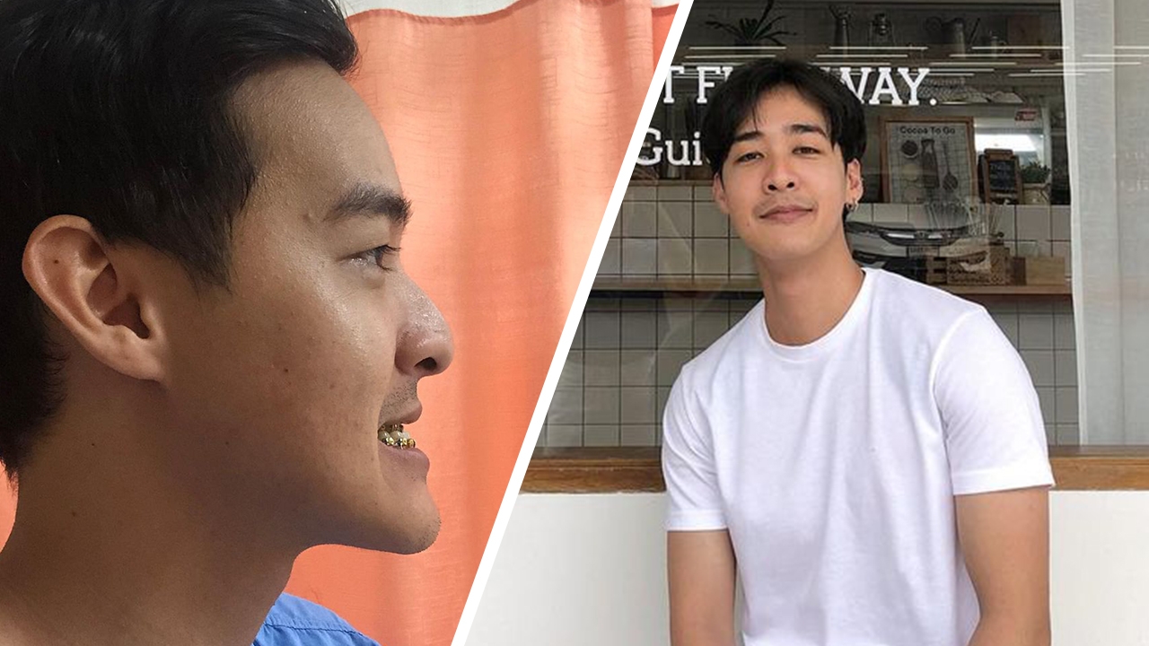 หม่อมเอ็ม ลุคใหม่หล่อมาก หลังผ่าตัดขากรรไกร คิดไม่ผิดที่ตัดสินใจทำ