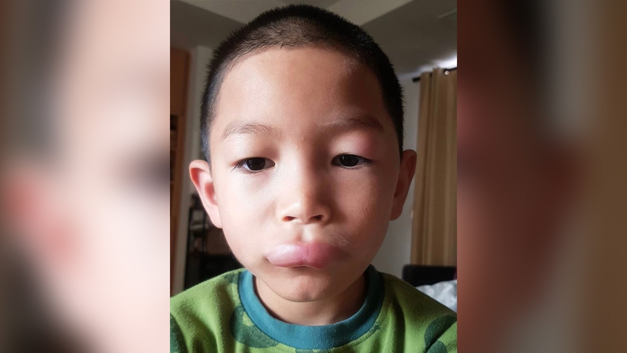 หัวอกแม่ พลอย ตกใจ น้องพูม่า ปากบวม รีบพาหาหมอก่อนตามล่าเจ้าวายร้าย