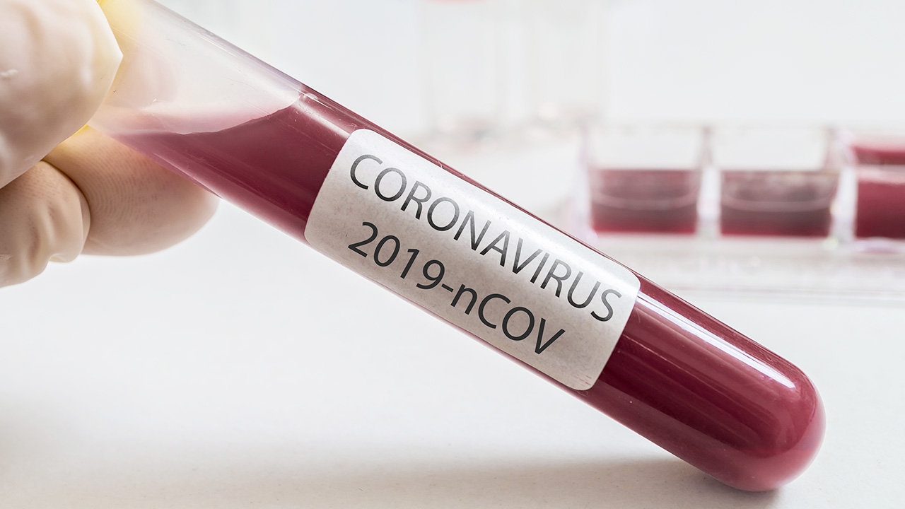 เปิดไทม์ไลน์ หนุ่มภูเก็ต ติดโควิด-19 หลังสัมผัสผู้ป่วยยืนยัน จ.สมุทรสาคร