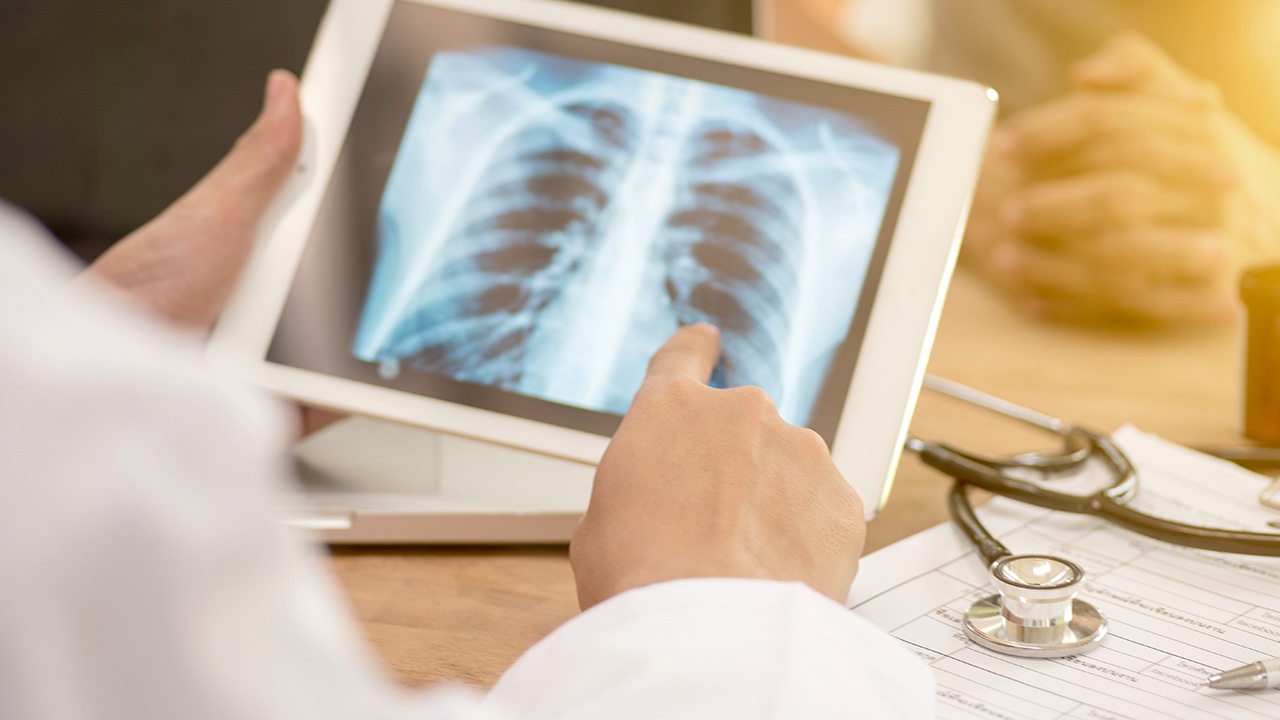 ไทม์ไลน์ แม่ค้าขายปลา สมุทรสาคร ป่วยโควิด-19 คนในครอบครัวพบเชื้อ 3 ราย