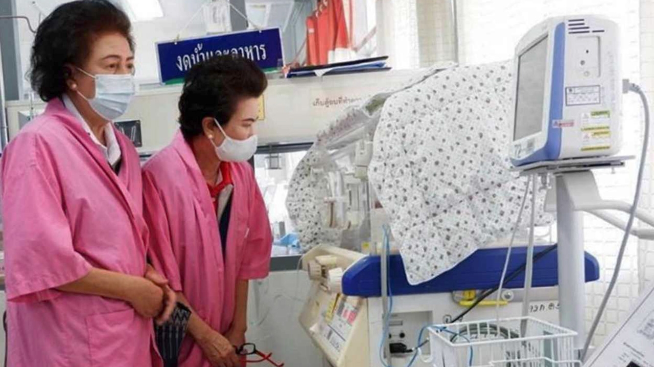 หมอผ่าทำคลอดสาววัย 22 ตะลึง พบทารกเพศหญิง มี 4 แขน 4 ขา อวัยวะครบ