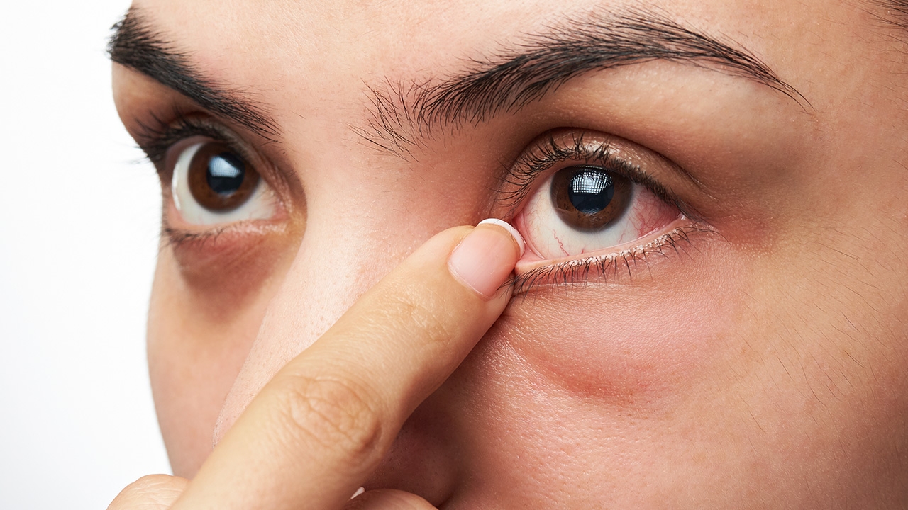 หมอแล็บเตือน โรคจอประสาทตาเสื่อมก่อนเวลาอันควร ภัยเงียบจากวิถีชีวิตรูปแบบใหม่