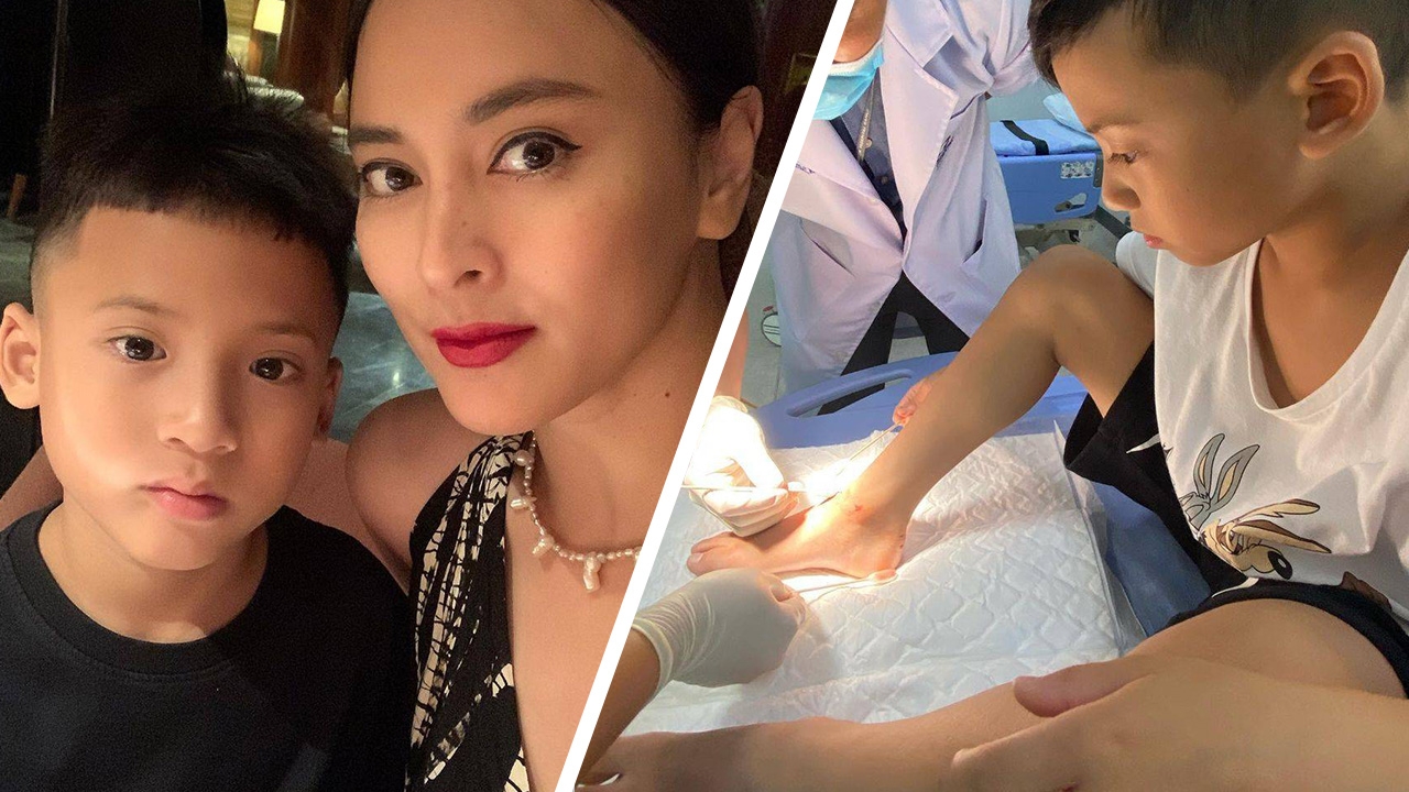 นานา มือไม้สั่น น้องบรู๊คลิน เล่นซนจนได้แผลที่เท้า ต้องเย็บ 5 เข็ม