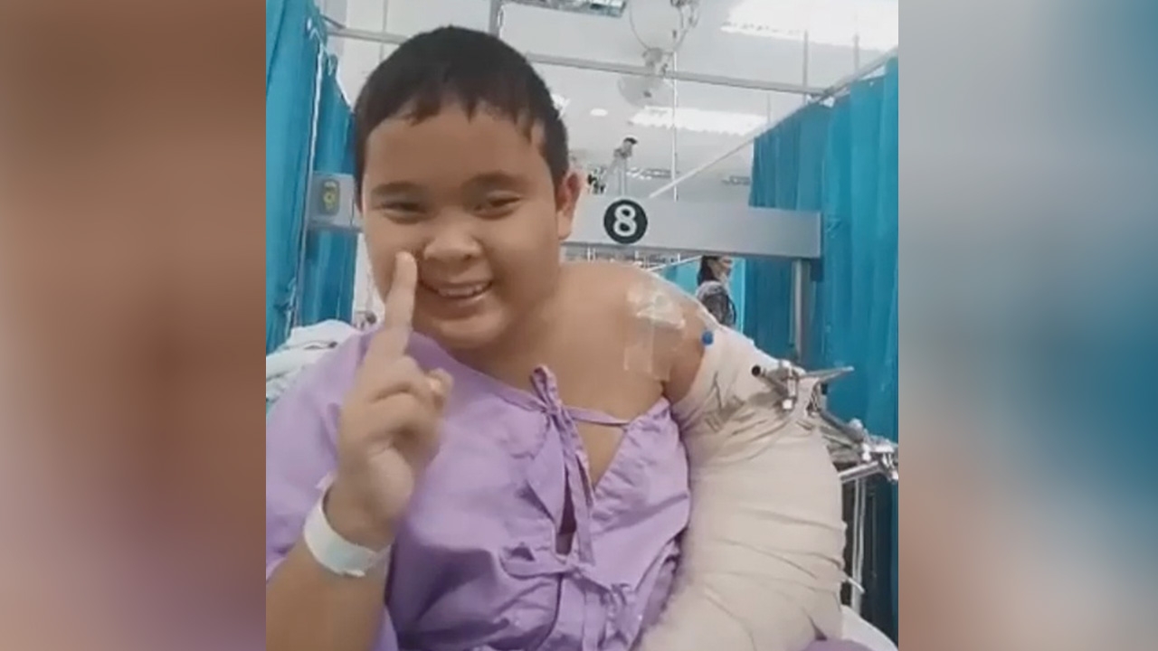 สัญญาณดี ‘น้องแมนยู’ แขนซ้ายที่ขาด เริ่มรับความรู้สึกได้แล้ว