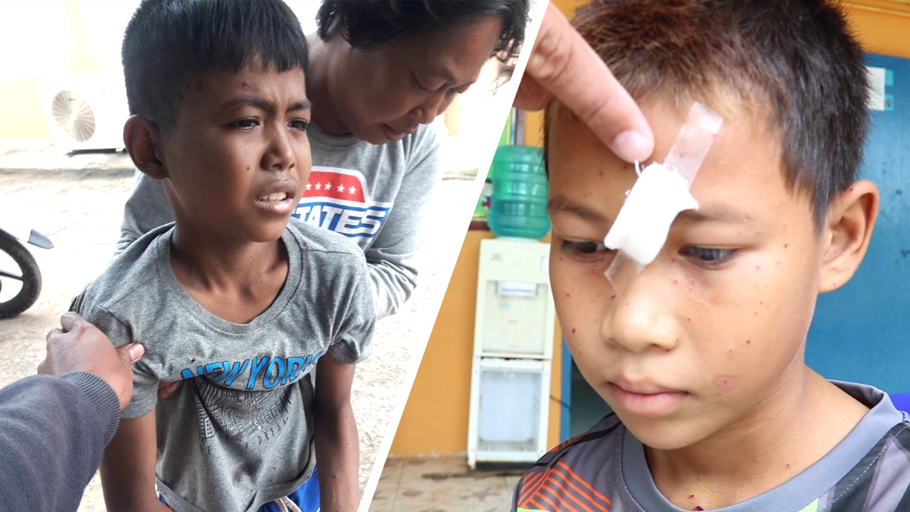 2 เด็กซนจนได้เรื่อง นำระเบิดปิงปองยัดขวดเบียร์ ตูมสนั่นมือขาดกระจุย