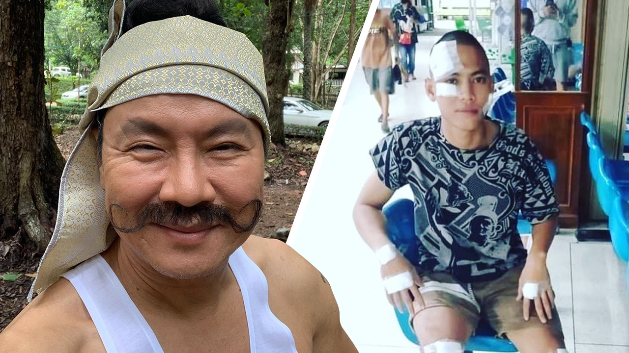 จตุรงค์ โพสต์ภาพ น้องพี อดีตตลกเด็กชื่อดัง ประสบอุบัติเหตุมีแผลเต็มตัว