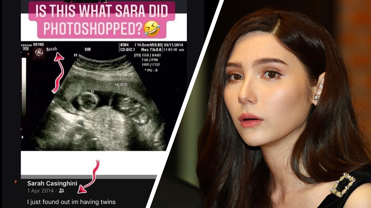 คนจับผิดภาพอัลตราซาวนด์ในเฟซบุ๊ก ซาร่า คล้ายรูปในข่าว เซเลน่า โกเมซ