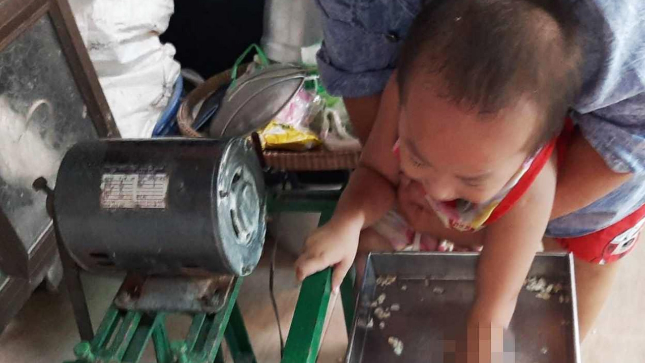 สุดเสียว หนูน้อยแหย่มือเข้าเครื่องบด ย่าชักปลั๊ก โชคดีแค่นิ้วหัก 