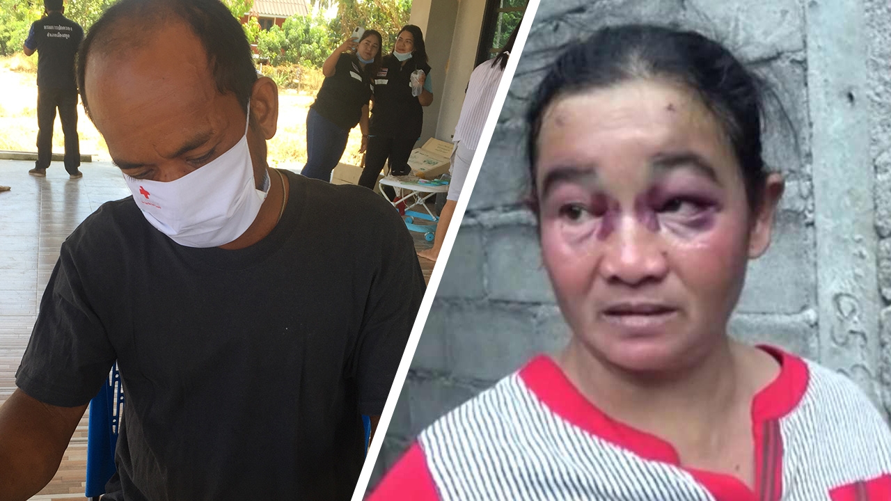 แจ้ง 4 ข้อหาลูกเขยโหด ชกเบ้าตาแม่ยาย อ้างโดนทำร้ายก่อน 