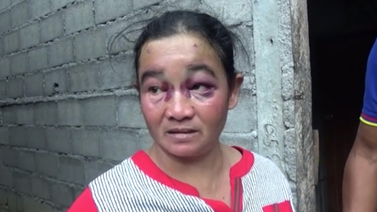 ลูกเขยโหด เมียหนี ตามเอาเรื่องแม่ยาย บุกต่อยเบ้าตาช้ำ