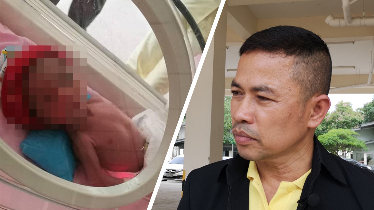 "สารวัตรเอก" ตำรวจคนดังข้องใจ หลานสาวแรกเกิดขาหัก ทั้งที่อยู่ในตู้อบ