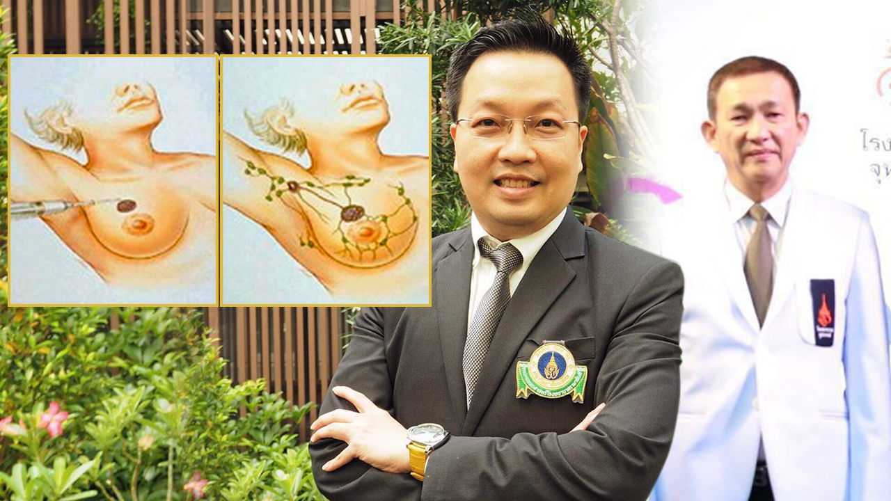 เสริมภูมิคุ้มกัน "หญิงไทย" เติมความรู้สู้ "เพชฌฆาตร้าย"โรคมะเร็งเต้านม