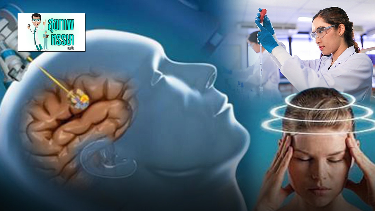 หมอสมองดีใจ...มียาลดความดันสูงในสมองแล้ว