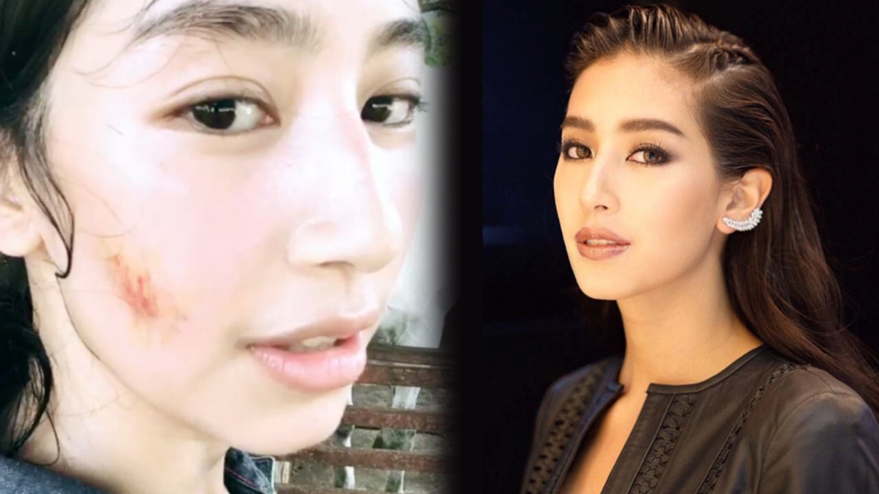 มิ้นต์ ชาลิดา เผยโฉมคู่กรณี ทำหน้าสวยๆ เกือบพัง!!