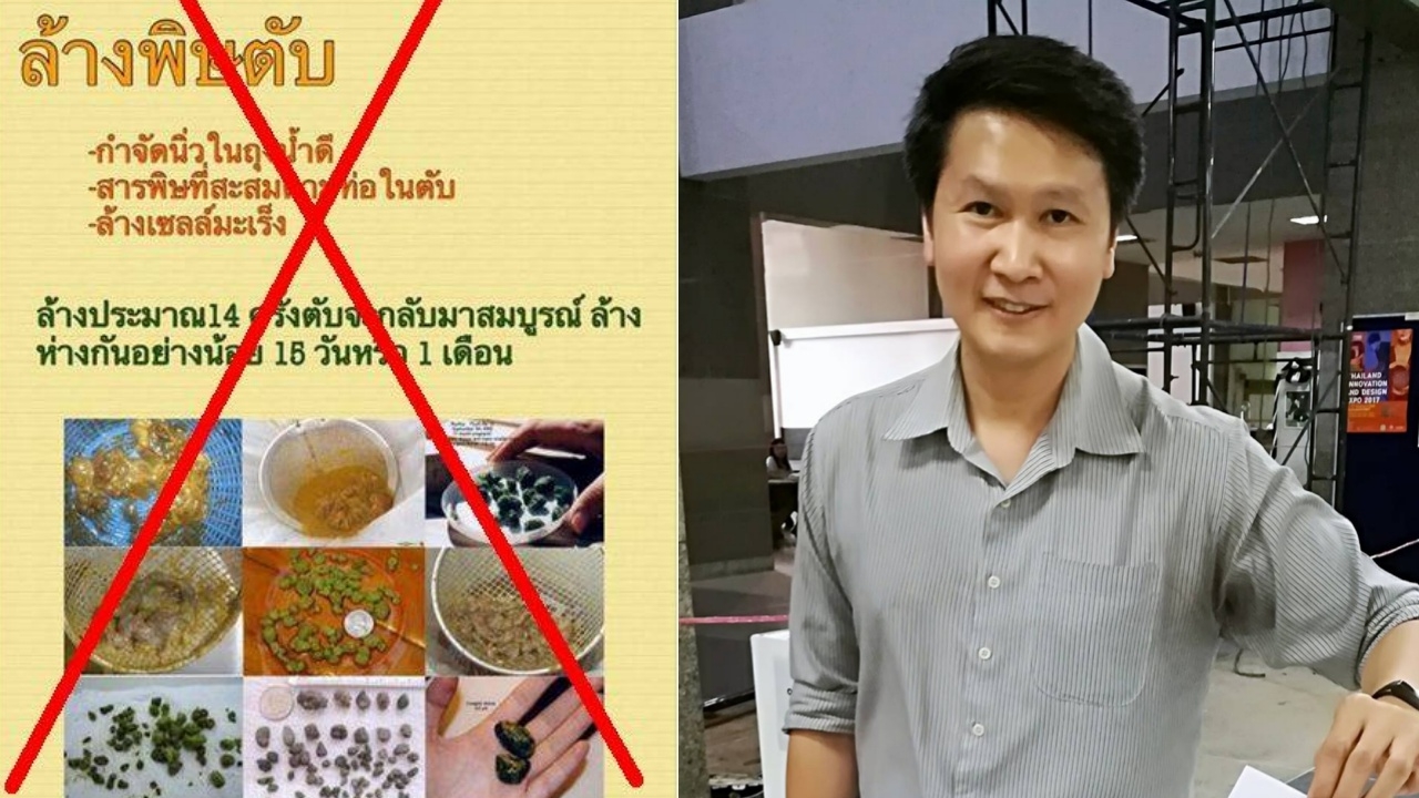 อ.เจษฎ์ เตือนอย่าเชื่อ! น้ำมันมะกอกผสมมะนาวล้างพิษตับกำจัดนิ่วถุงน้ำดี