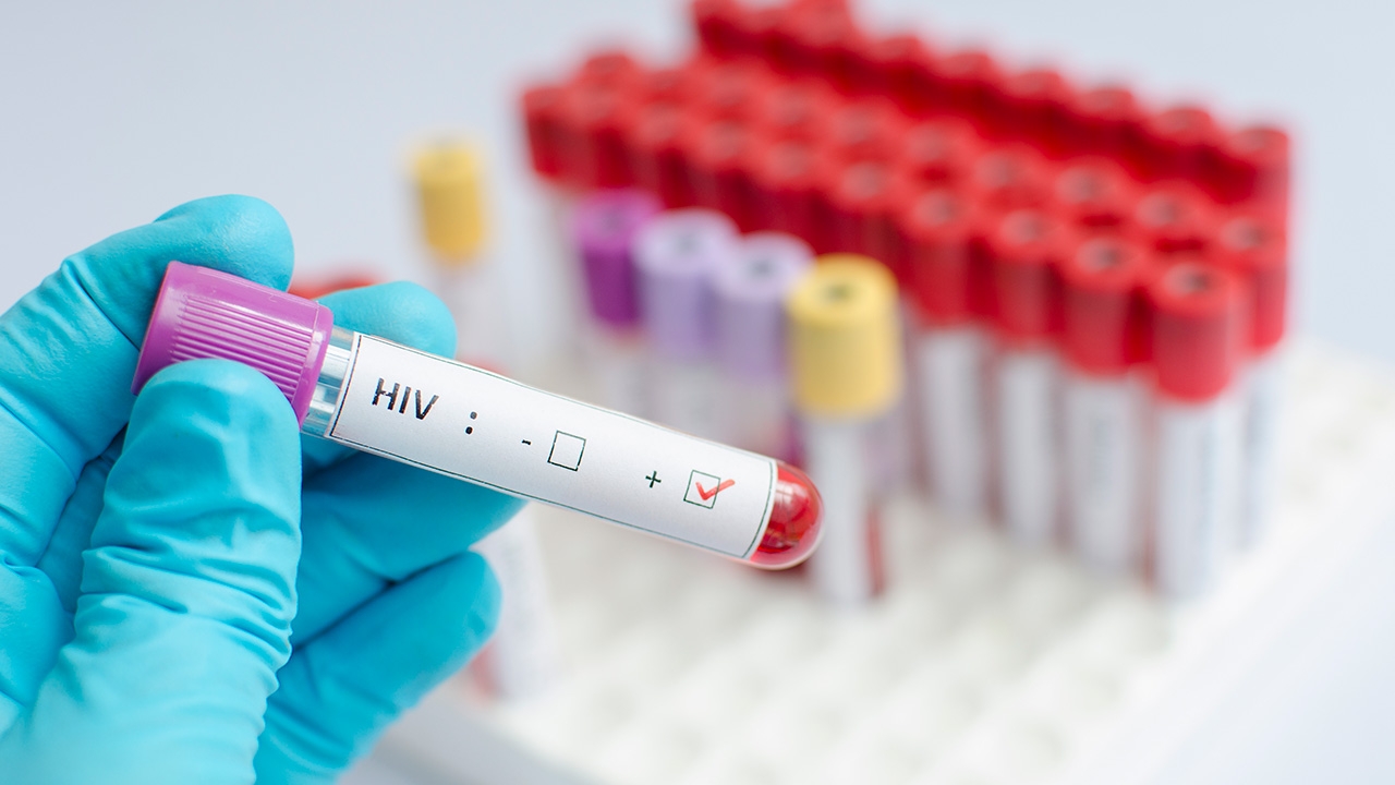 กทม.เอดส์เพิ่ม 484 จตุจักรเพิ่มมากสุด