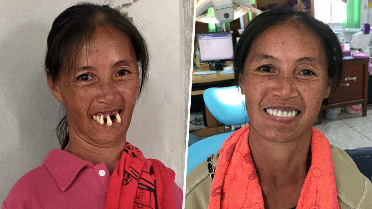 พลิกชีวิตสาวใบ้ ให้กลับมามั่นใจ กล้าสื่อสารคนอื่น
