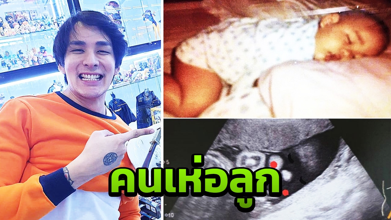 คนเห่อลูก แทค ภรัณยู อวดภาพอัลตราซาวนด์น้องพารัน งานนี้สำเนาถูกต้อง