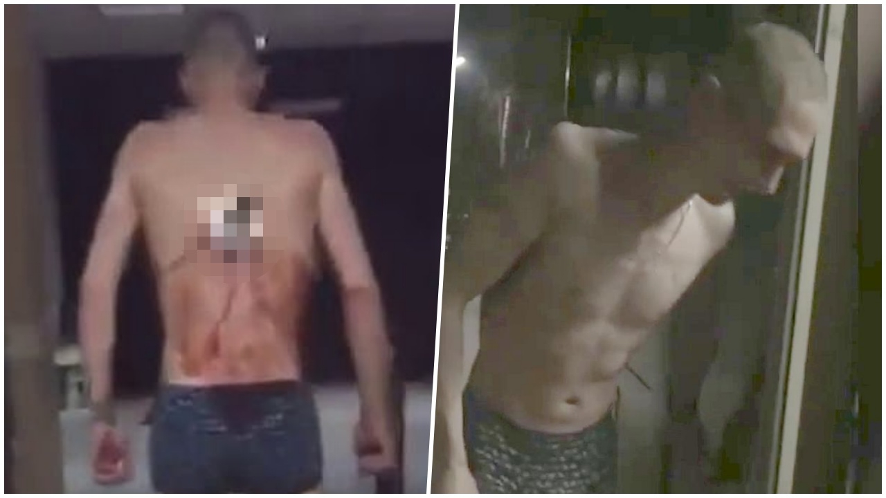 หนุ่มรัสเซียสุดทรหด มีดปักกลางหลังไม่ยอมรักษา ฝ่าอากาศหนาวไปสูบบุหรี่ (คลิป)