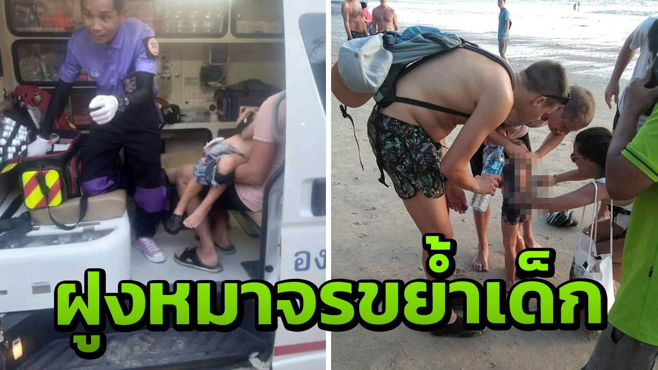สยองฝูงสุนัขจรจัด หาดอ่าวนาง รุมขย้ำ ด.ช.ชาวฟินแลนด์ วัย 5 ขวบ สาหัส