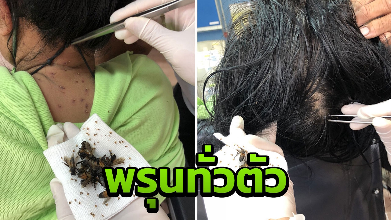 ผัวเมียหวิดดับ! ผึ้งหลวงนับพันรุมต่อย เร่งดึงเหล็กในออก ให้ออกซิเจน