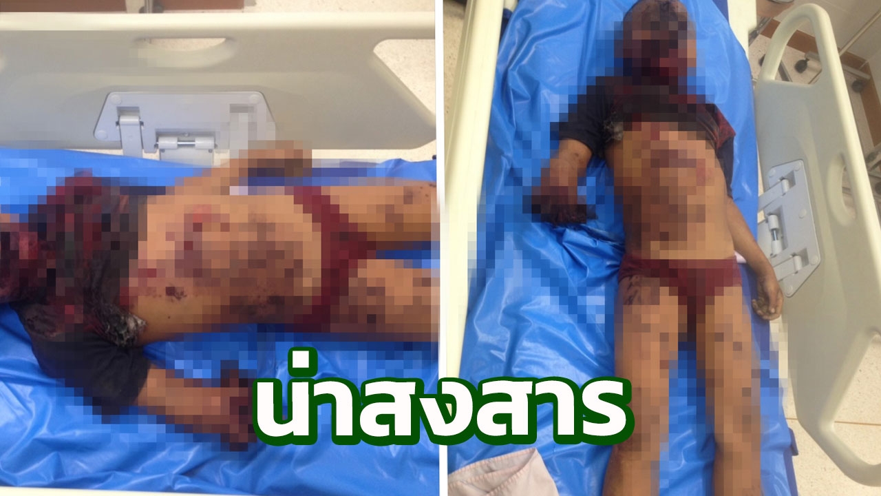สุดเคราะห์ร้าย ด.ช.วัย 7 ขวบ เก็บเห็ดถอบฝั่งเมียนมา เหยียบระเบิดดับ