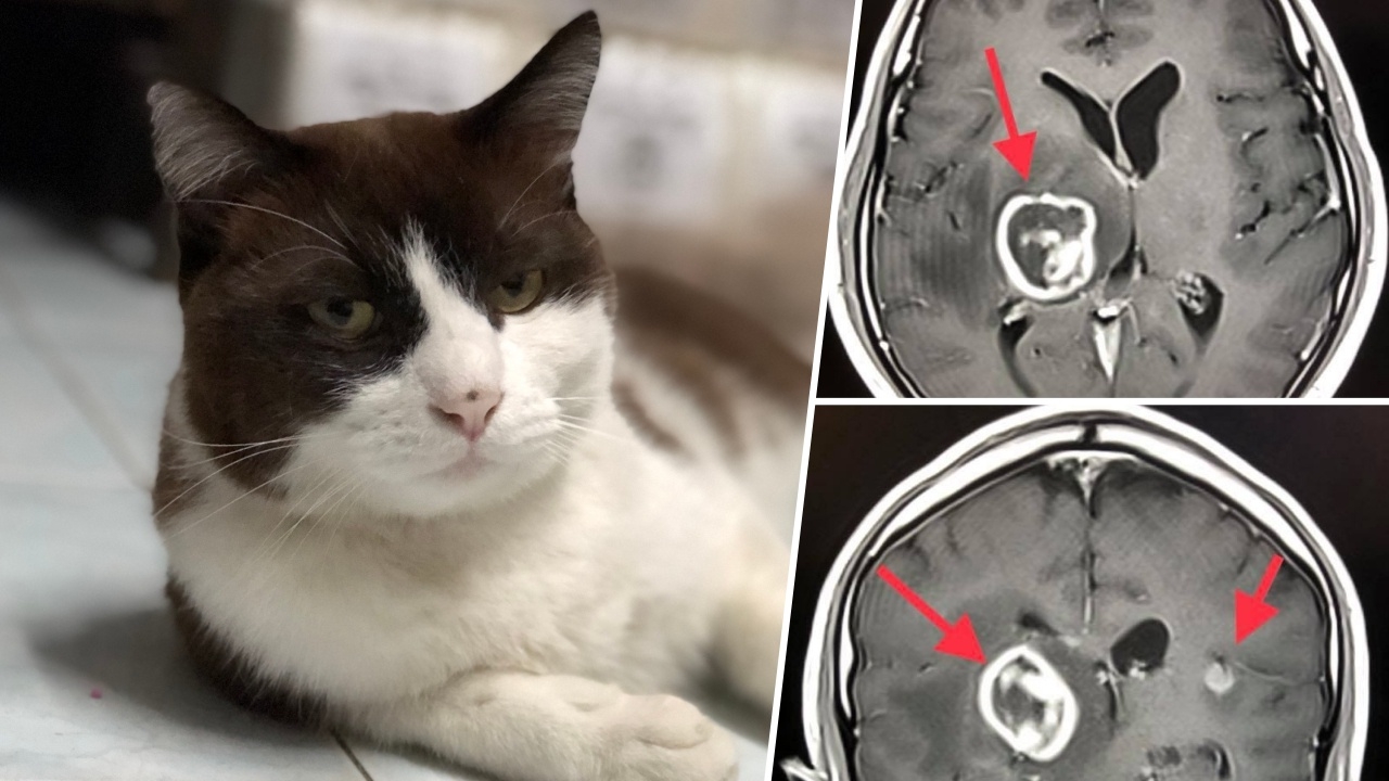 เก็บอึแมวต้องระวัง! ชายวัย 49 ป่วยแขนขาอ่อนแรง มีไข้ ตรวจพบ ‘ฝีในสมอง’