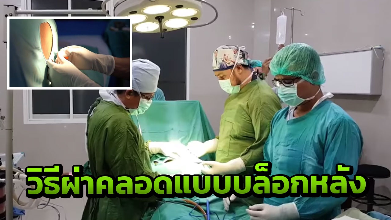 เผยคลิปวิธีการผ่าคลอดแบบบล็อกหลัง คุณแม่มือใหม่ควรดู