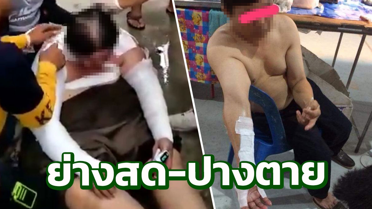 โหด! ราดน้ำมันจุดไฟเผาแม่ค้าปางตาย สามี-เพื่อนแม่ค้าช่วยดับทัน