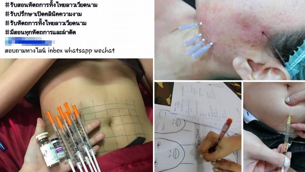 สวยหรือพัง! ผุดคอร์สเถื่อนสอนร้อยไหม โบท็อกซ์ ไม่ใช่หมอก็เปิดคลินิกได้