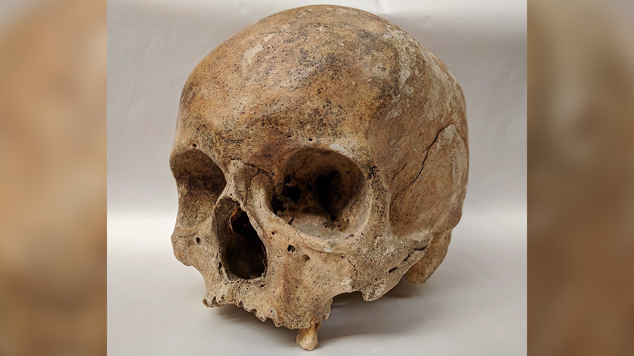 ใช้ดีเอ็นเอวิจัยสายพันธุ์ โรคเรื้อนในสมัยกลาง