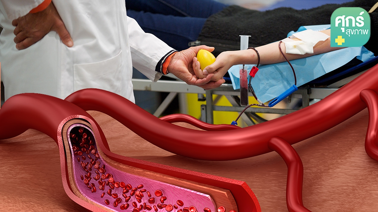 เผชิญโรคเลือดออกง่าย “ฮีโมฟีเลีย” อย่างเป็นสุข (ตอน 2)