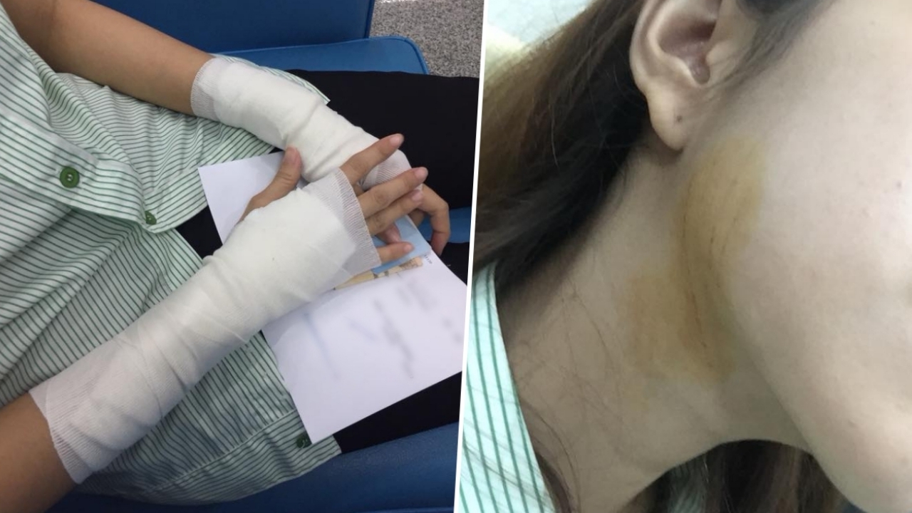 สาวเตือนภัย! คนเมาไถเงิน ตวัดคัตเตอร์กรีดหน้า-แขนเป็นแผล โชคดีมีคนช่วย