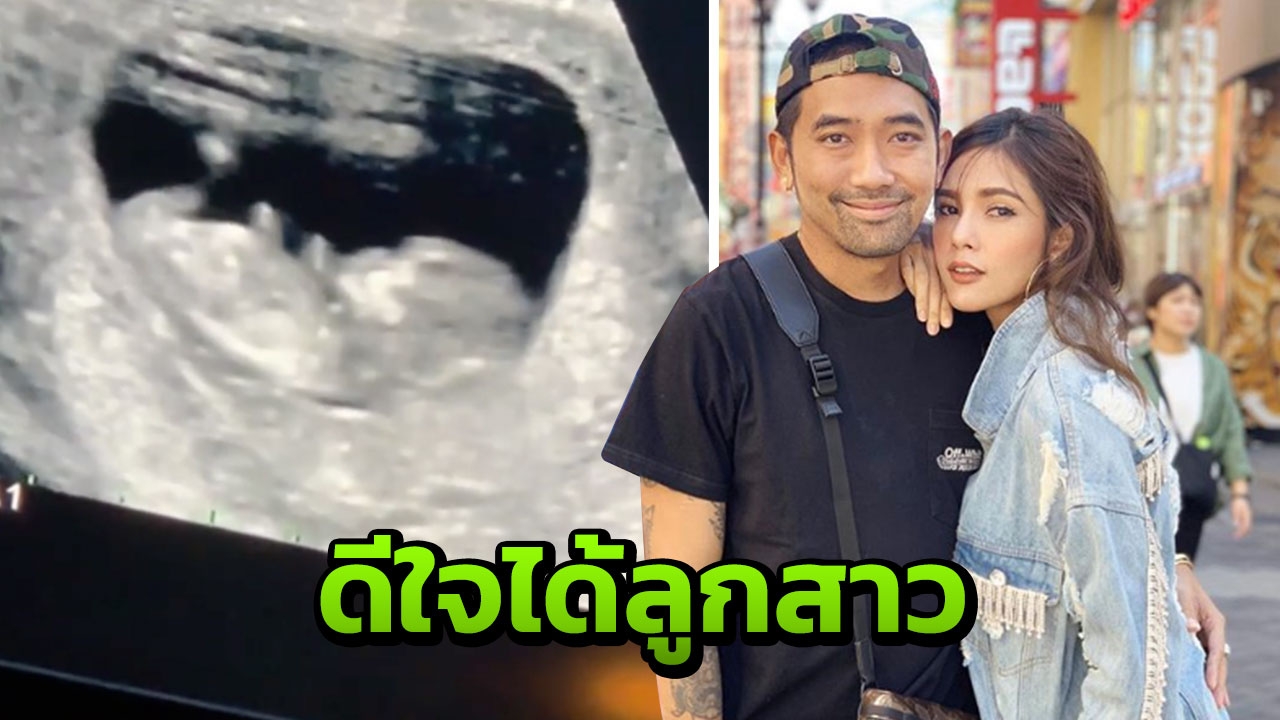 อุ้ม-บอล จัดปาร์ตี้เฉลยเพศลูก กอดคอยิ้มแก้มปริทำเพื่อนลุ้นตาม (คลิป)