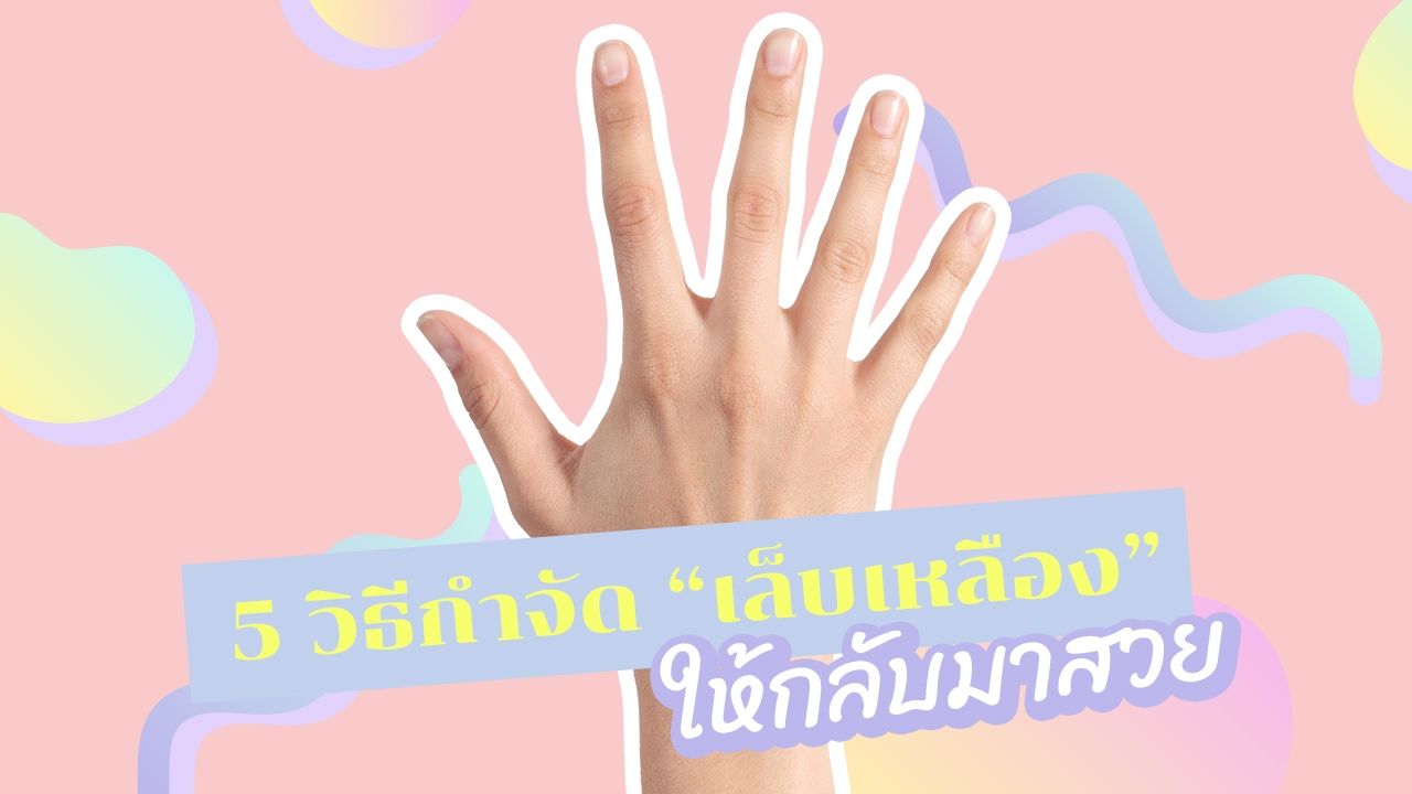 5 วิธีกำจัด "เล็บเหลือง" ให้สิ้นซาก บอกลาปัญหานิ้วไม่น่ามอง