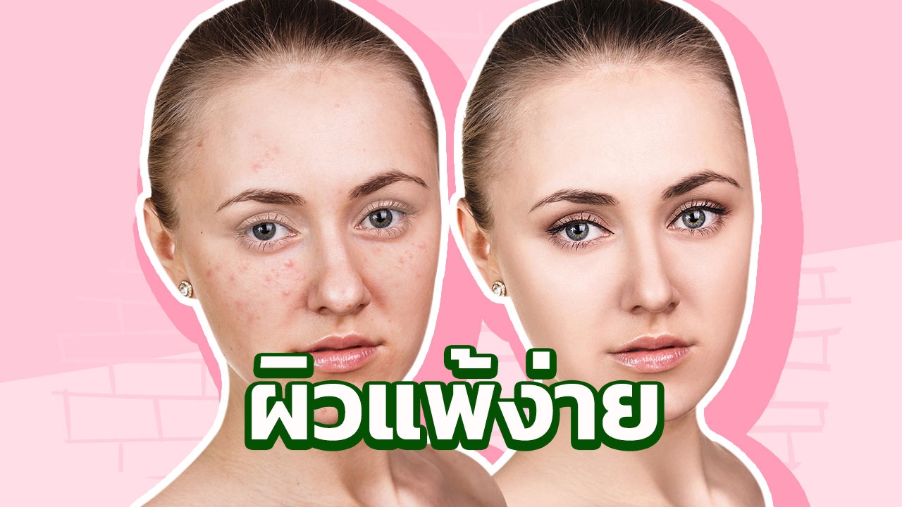 4 เคล็ดลับดูแลผิวหน้าให้เรียบ เนียน ใส สำหรับผู้ที่ "ผิวแพ้ง่าย" 