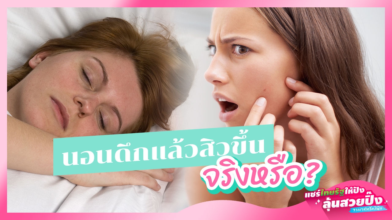 9 สาเหตุเกิดสิว 'นอนดึก' ทำให้ 'สิว' ขึ้นเยอะจริงหรือไม่?