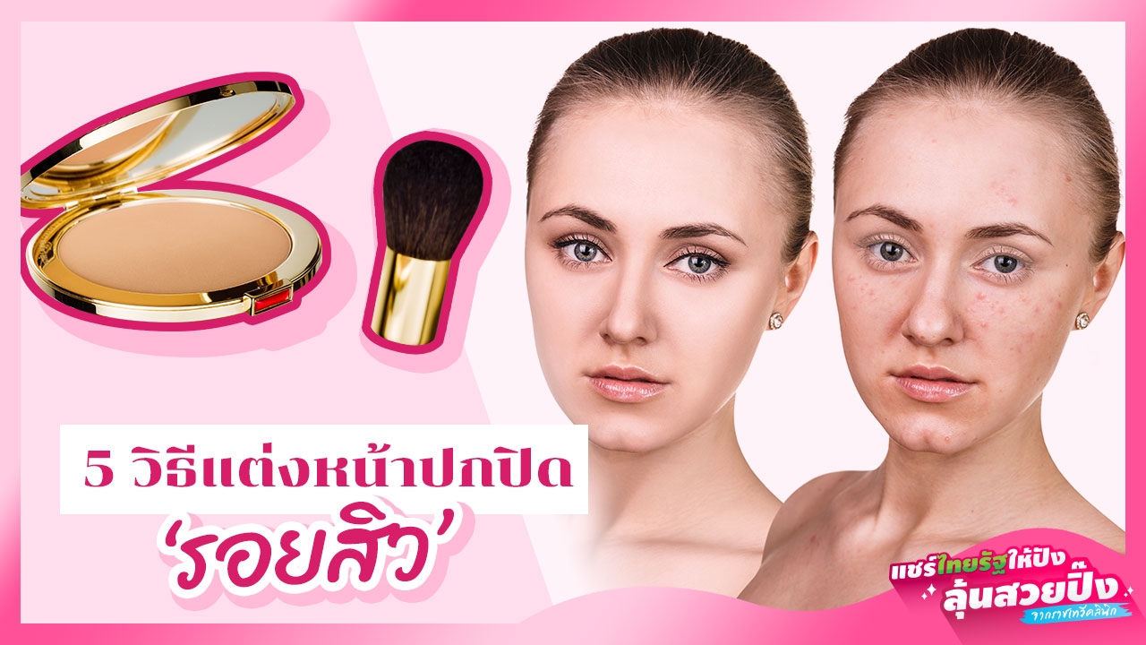 5 วิธีแต่งหน้าปกปิด 'รอยสิว' อยู่หมัด เผยผิวสวยเรียบเนียน