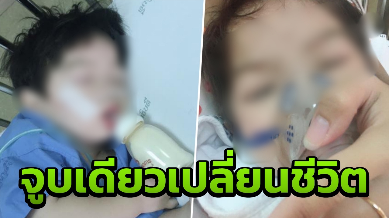 แม่ปวดใจ ลูกติดเชื้อ RSV ต้องเข้า รพ.ทุกเดือน หลังโดนคนแปลกหน้าจุ๊บปาก