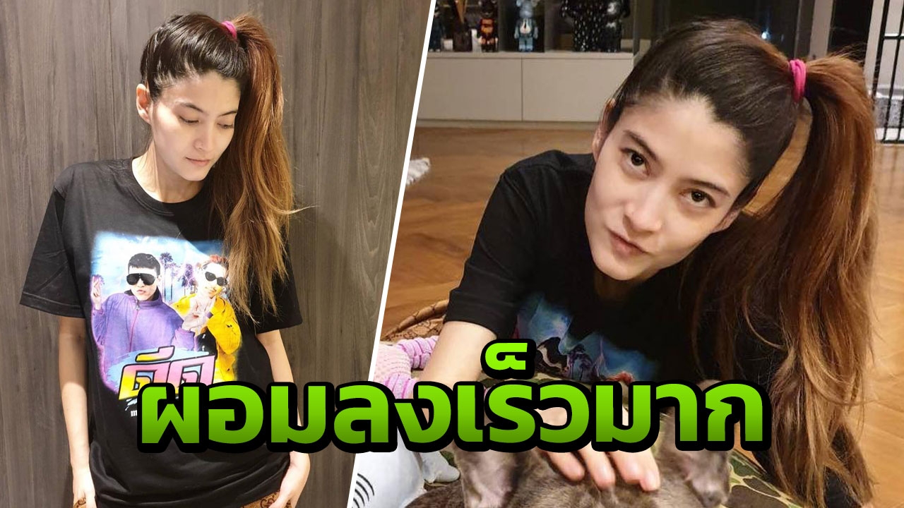 มาร์กี้ โพสต์ภาพล่าสุดผอมลงเร็วมาก แฟนคลับห่วง-แนะตรวจไทรอยด์