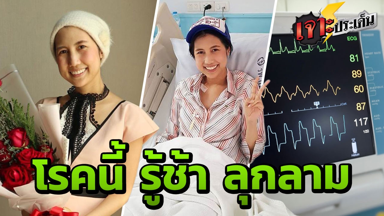 รู้จัก “โรคร้าย” พรากหมอเมย์ ไม่เจ็บปวด ลุกลาม รู้ตัวอีกที เหลือเวลาไม่นาน 