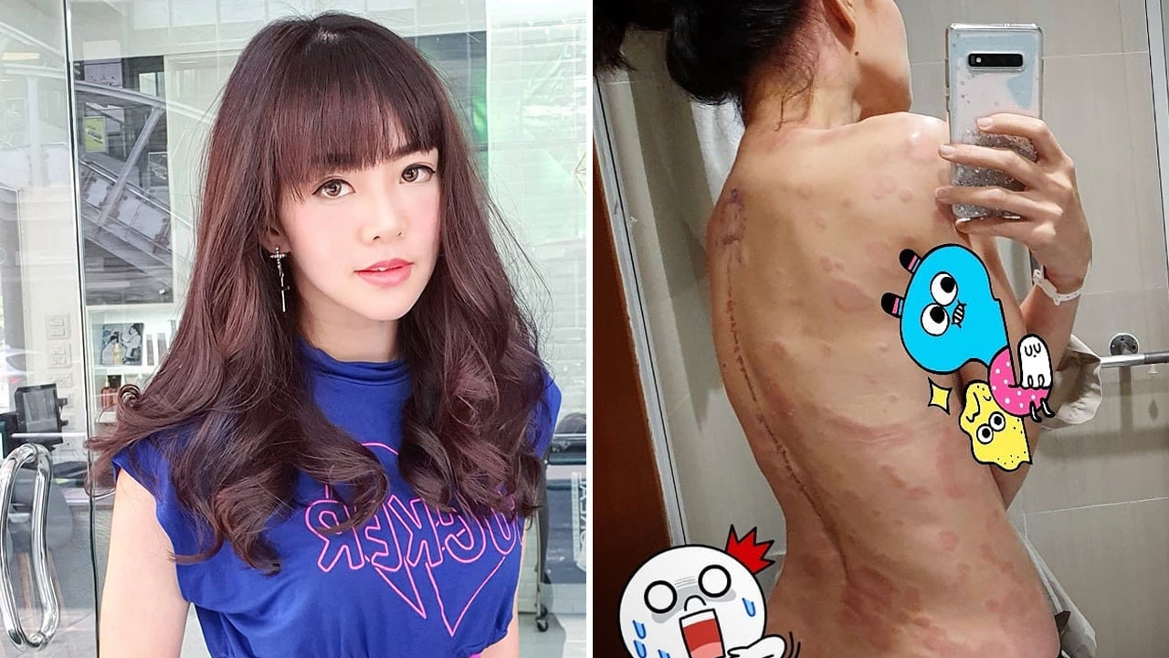 ตกใจอย่างหนัก แนนนี่ เกิร์ลลี่เบอร์รี่ ต้องแอดมิทด่วน 